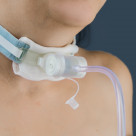 Фильтр дыхательный с тепловлагообменником из бумаги и кислородной трубкой, Т-образный, для трахеостомы на пациенте