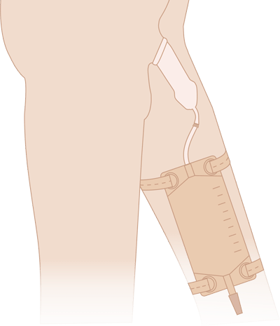 Мочеприемник носимый  Стандарт, объем 750 мл. трубка 50 см.